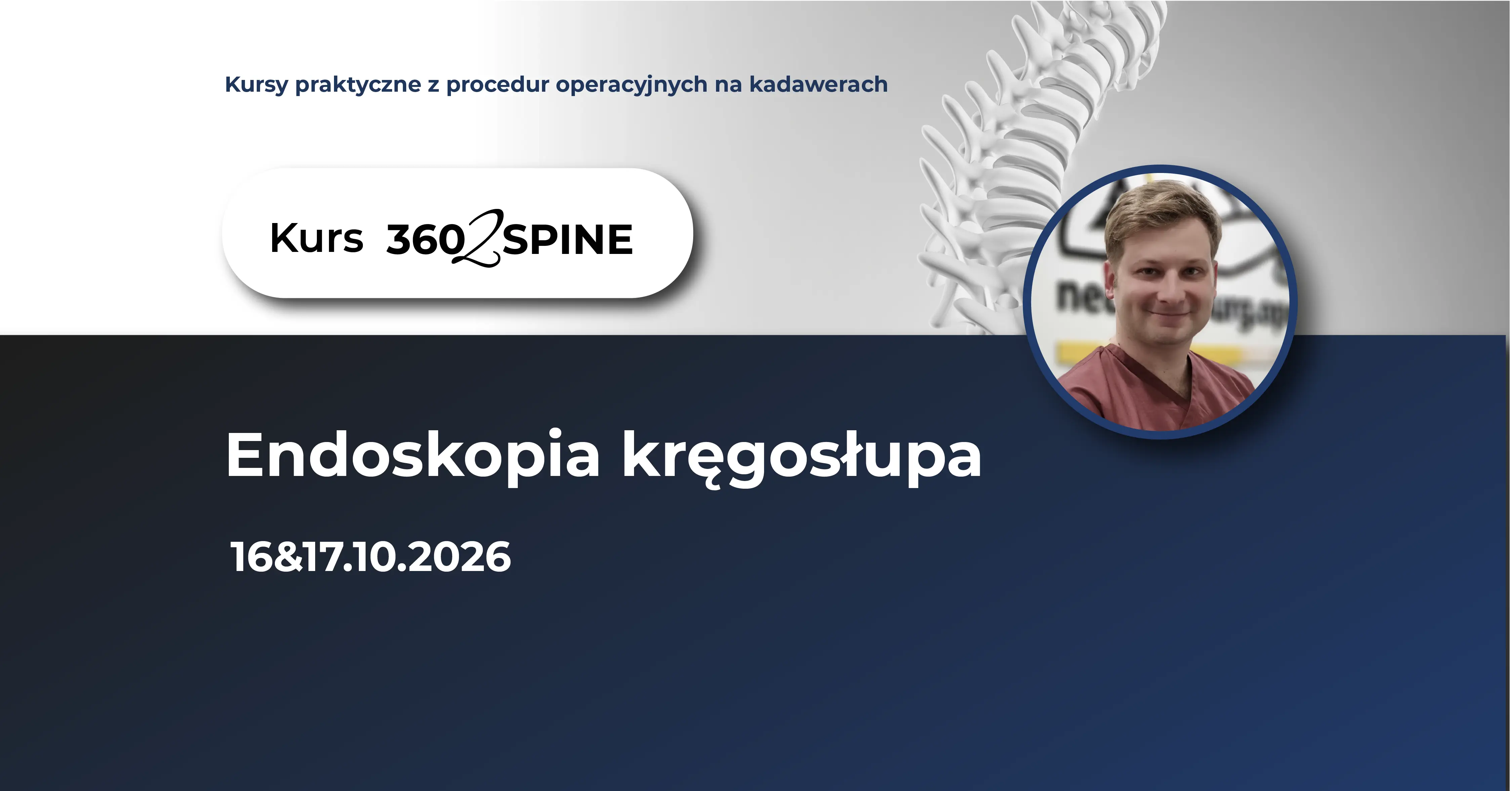 Endoskopia kręgosłupa